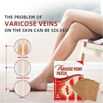 Varicose Vein Relief Patch