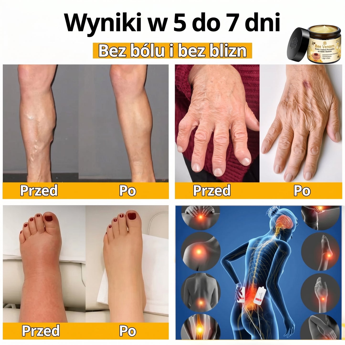 | KUP 1, OTRZYMAJ 2 | Bee Venom™ – Naturalna Regeneracja dla Gładkiej i Młodziej Wyglądającej Skóry