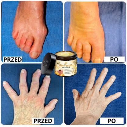 | KUP 1, OTRZYMAJ 2 | Bee Venom™ – Naturalna Regeneracja dla Gładkiej i Młodziej Wyglądającej Skóry